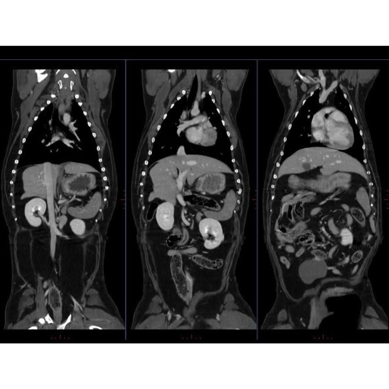 CT Scanner Device Internal